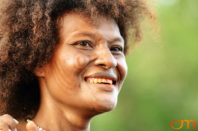 Photo of a woman with Solomon Island traditional facial scarification. Taken in the Malaita Province by Amanda Fornal in December 2006.