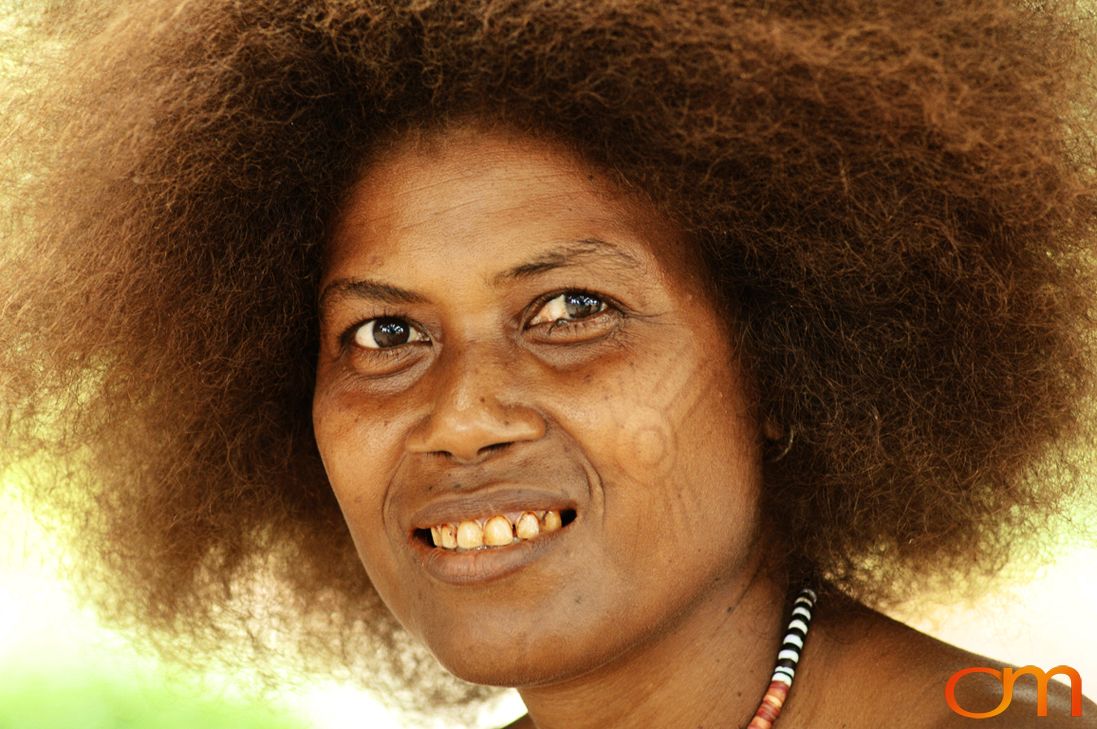 Photo of a woman with Solomon Island traditional facial scarification. Taken in the Malaita Province by Amanda Fornal in December 2006.