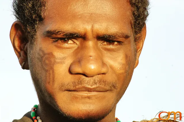 Photo of a man with Solomon Island traditional facial scarification. Taken in the Malaita Province by Amanda Fornal in December 2006.