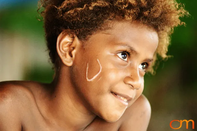 Photo of a girl with Solomon Island traditional facial scarification. Taken of Caroline in the Malaita Province by Amanda Fornal in December 2006.