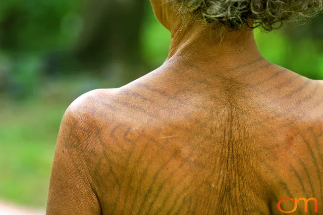 Photo of Vanuatu woman with a traditional tattoo on her shoulders and back. Taken of Julliet on the Vanuatu Island of Ambae by Amanda Fornal in December 2006.