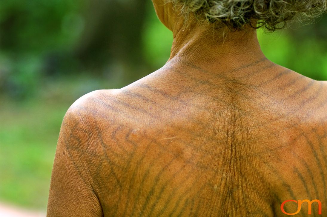 Photo of Vanuatu woman with a traditional tattoo on her shoulders and back. Taken of Julliet on the Vanuatu Island of Ambae by Amanda Fornal in December 2006.