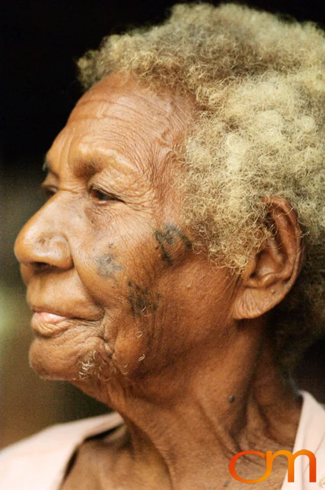 Photo of Vanuatu woman with a traditional tattoo on her face. Taken on the Vanuatu Island of Mota Lava by Amanda Fornal in December 2006.