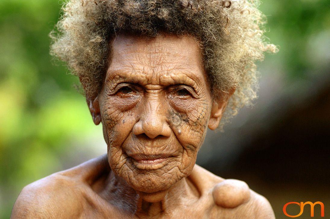 Photo of Vanuatu woman with a traditional tattoo on her face. Taken on the Vanuatu Island of Mota Lava by Amanda Fornal in December 2006.